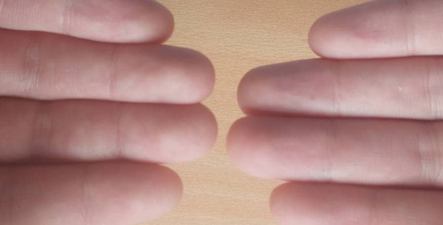 fingertips of bass player with calluses